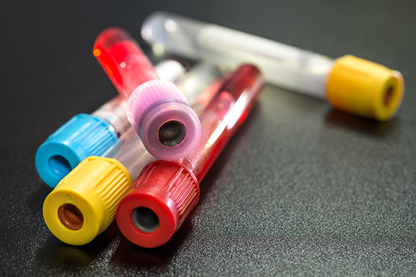 Blood test tubes